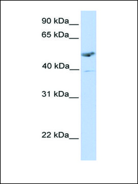 Anti-ST3GAL1 antibody produced in rabbit affinity isolated antibody