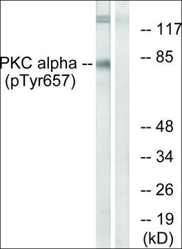 Anti-phospho-PKC &#945; (pTyr657) antibody produced in rabbit affinity isolated antibody