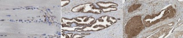 Anti-Utrophin A from rabbit