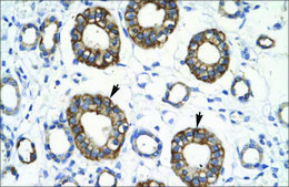 Anti-RFP2 (AB1) antibody produced in rabbit affinity isolated antibody