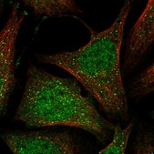 Anti-MOSPD1 antibody produced in rabbit Prestige Antibodies® Powered by Atlas Antibodies, affinity isolated antibody, buffered aqueous glycerol solution