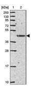 Anti-FUT10 antibody produced in rabbit Prestige Antibodies® Powered by Atlas Antibodies, affinity isolated antibody, buffered aqueous glycerol solution