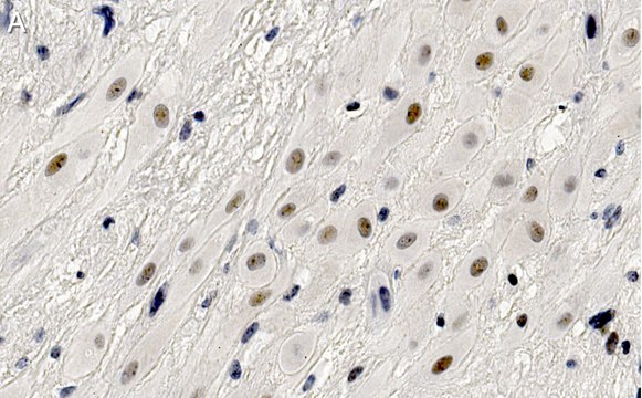 Anti-HDAC7 Antibody, clone 1L17 ZooMAb&#174; Rabbit Monoclonal recombinant, expressed in HEK 293 cells