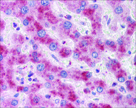 Anti-ATG16L1 (AB1) antibody produced in rabbit affinity isolated antibody