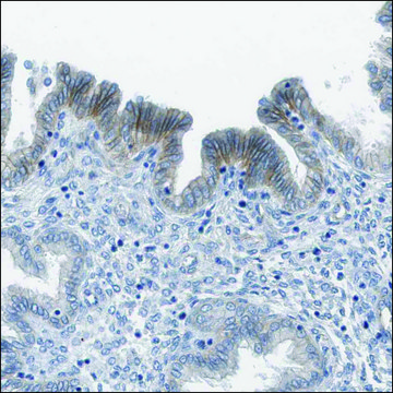 Anti-SLC6A6 antibody produced in rabbit Prestige Antibodies&#174; Powered by Atlas Antibodies, affinity isolated antibody, buffered aqueous glycerol solution, Ab1