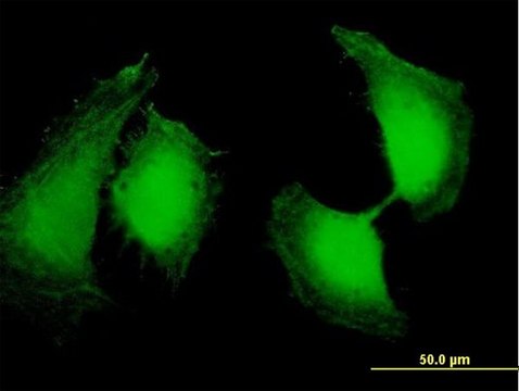 Anti-OSTF1 antibody produced in mouse purified immunoglobulin, buffered aqueous solution