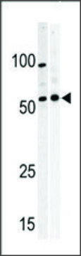 Anti-PKMYT1 (C-term) antibody produced in rabbit IgG fraction of antiserum, buffered aqueous solution