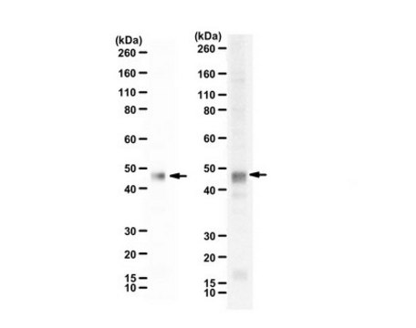 Anti-Vaccinia related kinase-1 Antibody, C-Terminus from rabbit