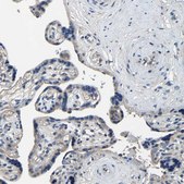 Anti-KIAA1958 antibody produced in rabbit Prestige Antibodies® Powered by Atlas Antibodies, affinity isolated antibody, buffered aqueous glycerol solution