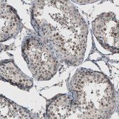 Anti-PUM3 antibody produced in rabbit Prestige Antibodies® Powered by Atlas Antibodies, affinity isolated antibody, buffered aqueous glycerol solution