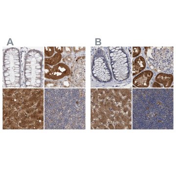 Anti-PNPO antibody produced in rabbit Prestige Antibodies&#174; Powered by Atlas Antibodies, affinity isolated antibody, buffered aqueous glycerol solution