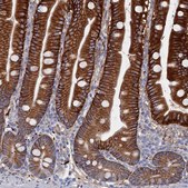 Anti-C12orf73 antibody produced in rabbit Prestige Antibodies® Powered by Atlas Antibodies, affinity isolated antibody, buffered aqueous glycerol solution