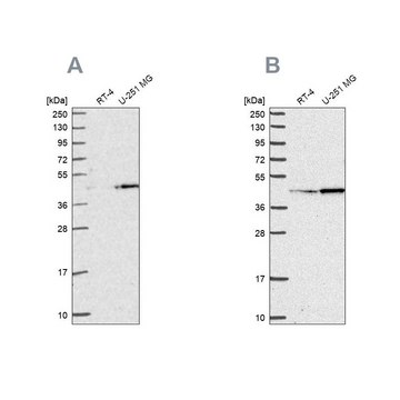 Anti-WDR18 antibody produced in rabbit Prestige Antibodies&#174; Powered by Atlas Antibodies, affinity isolated antibody, buffered aqueous glycerol solution