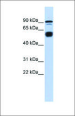 Anti-BCL11A antibody produced in rabbit affinity isolated antibody
