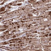 Anti-SYNPO2L antibody produced in rabbit Prestige Antibodies® Powered by Atlas Antibodies, affinity isolated antibody, buffered aqueous glycerol solution