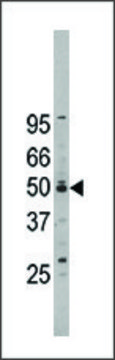 Anti-NOC2L (center) antibody produced in rabbit IgG fraction of antiserum, buffered aqueous solution