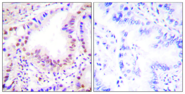 Anti-ETS1 antibody produced in rabbit affinity isolated antibody