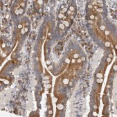Anti-EDEM3 antibody produced in rabbit Prestige Antibodies® Powered by Atlas Antibodies, affinity isolated antibody, buffered aqueous glycerol solution, Ab2
