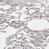 Anti-KLHL6 antibody produced in rabbit Prestige Antibodies® Powered by Atlas Antibodies, affinity isolated antibody, buffered aqueous glycerol solution