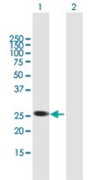 Anti-AGPAT1 antibody produced in mouse purified immunoglobulin, buffered aqueous solution