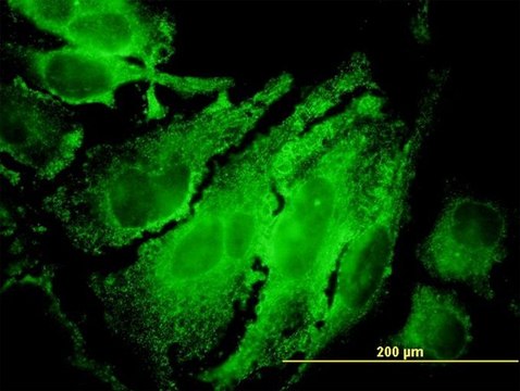 ANTI-RPS6KB1 antibody produced in mouse clone 4H4, purified immunoglobulin, buffered aqueous solution