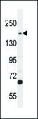 ANTI-TDRD7 (C-TERM) antibody produced in rabbit IgG fraction of antiserum, buffered aqueous solution