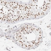 Anti-SUPT3H antibody produced in rabbit Prestige Antibodies® Powered by Atlas Antibodies, affinity isolated antibody, buffered aqueous glycerol solution
