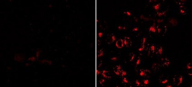 BioTracker 555 UV-Excitation Red Lysosome Dye Live cell imaging dye for acidic cellular organelles such as lysosomes.