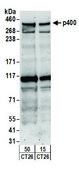 Rabbit anti-p400 Antibody, Affinity Purified Powered by Bethyl Laboratories, Inc.