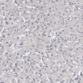Anti-RBM28 antibody produced in rabbit Prestige Antibodies® Powered by Atlas Antibodies, affinity isolated antibody, buffered aqueous glycerol solution, Ab2