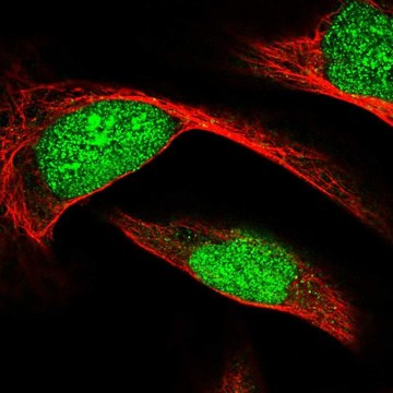 Anti-ECE2 antibody produced in rabbit Prestige Antibodies&#174; Powered by Atlas Antibodies, affinity isolated antibody