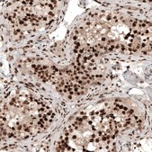 Anti-CBX5 antibody produced in rabbit Prestige Antibodies® Powered by Atlas Antibodies, affinity isolated antibody, buffered aqueous glycerol solution