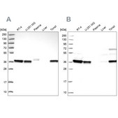 Anti-RALY antibody produced in rabbit Prestige Antibodies® Powered by Atlas Antibodies, affinity isolated antibody, buffered aqueous glycerol solution