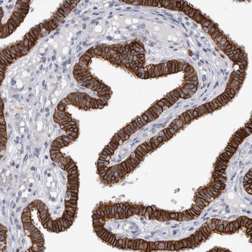 Anti-SLC20A2 antibody produced in rabbit Prestige Antibodies&#174; Powered by Atlas Antibodies, affinity isolated antibody, buffered aqueous glycerol solution