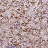 Anti-GPT2 antibody produced in rabbit Prestige Antibodies® Powered by Atlas Antibodies, affinity isolated antibody, buffered aqueous glycerol solution