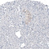 Monoclonal Anti-AMACR antibody produced in mouse Prestige Antibodies® Powered by Atlas Antibodies, clone CL9360, purified immunoglobulin, buffered aqueous glycerol solution