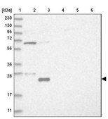Anti-UBE2E2 antibody produced in rabbit Prestige Antibodies® Powered by Atlas Antibodies, affinity isolated antibody, buffered aqueous glycerol solution