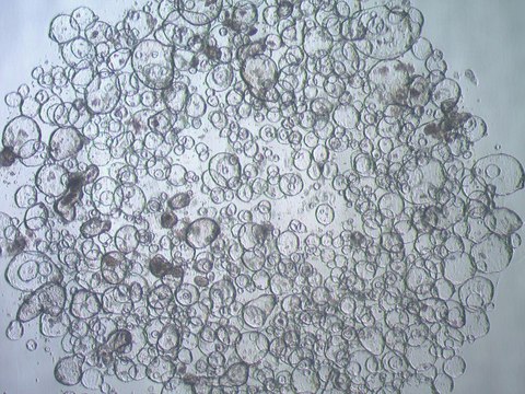 3dGRO&#174; Duodenum Intestinal Organoids, Age 21 (Prep 87-D) Cryopreserved patient derived gastrointestinal organoids (PDOs)