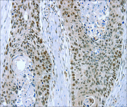 Anti-RNF20 affinity isolated antibody