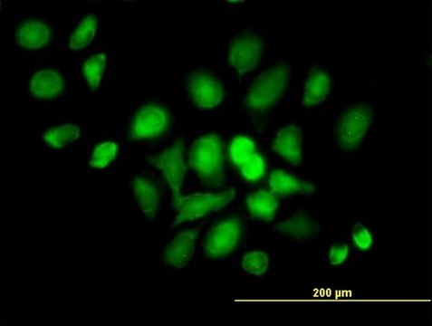 Anti-DDX20 antibody produced in mouse purified immunoglobulin, buffered aqueous solution