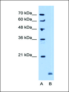 Anti-CRYAB antibody produced in rabbit IgG fraction of antiserum