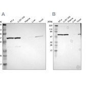 Anti-CCT5 antibody produced in rabbit Prestige Antibodies® Powered by Atlas Antibodies, affinity isolated antibody, buffered aqueous glycerol solution