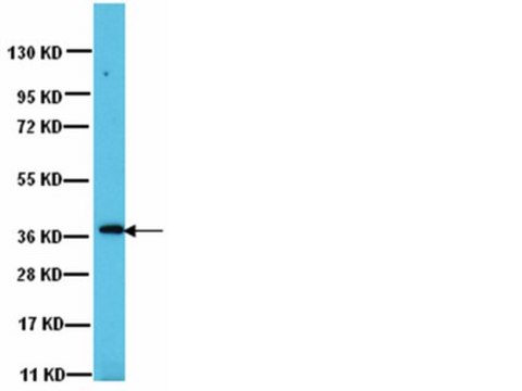 Anti-PP1&#947;1 Antibody Upstate&#174;, from rabbit