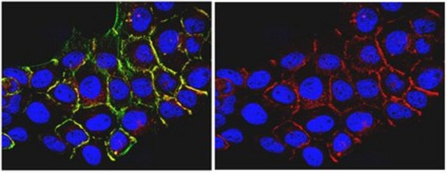 Anti-Pan-Ras Antibody, clone RAS 10 clone RAS 10, from mouse