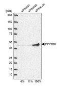 Anti-PPP1R8 antibody produced in rabbit Prestige Antibodies® Powered by Atlas Antibodies, affinity isolated antibody, buffered aqueous glycerol solution, Ab1