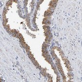 Anti-SIL1 antibody produced in rabbit Prestige Antibodies® Powered by Atlas Antibodies, affinity isolated antibody, buffered aqueous glycerol solution