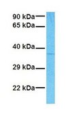 Anti-RAX (AB2) antibody produced in rabbit affinity isolated antibody