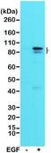 Anti-Phospho-STAT3 (Tyr705) antibody, Rabbit monoclonal recombinant, expressed in HEK 293 cells, clone RM261, purified immunoglobulin