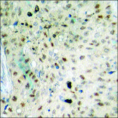Anti-phospho-ERF (pThr526) antibody produced in rabbit affinity isolated antibody
