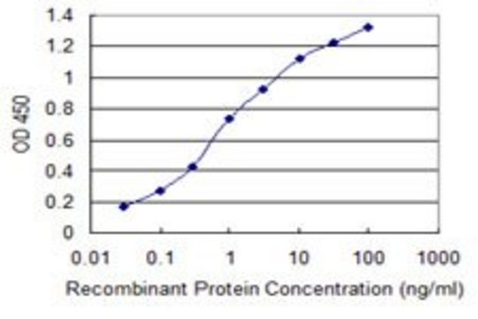 Monoclonal Anti-PIP5K2C antibody produced in mouse clone 3E10, purified immunoglobulin, buffered aqueous solution